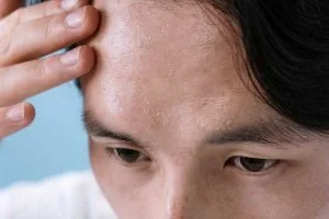 Heat Stroke Symptoms