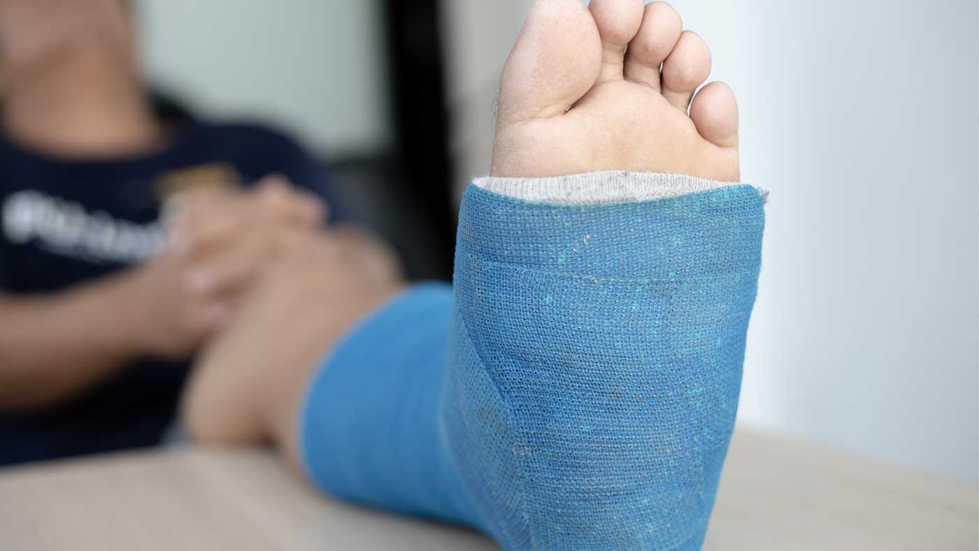 Comminuted Fracture Symptoms Causes And Treatment MultiTopicBlogs